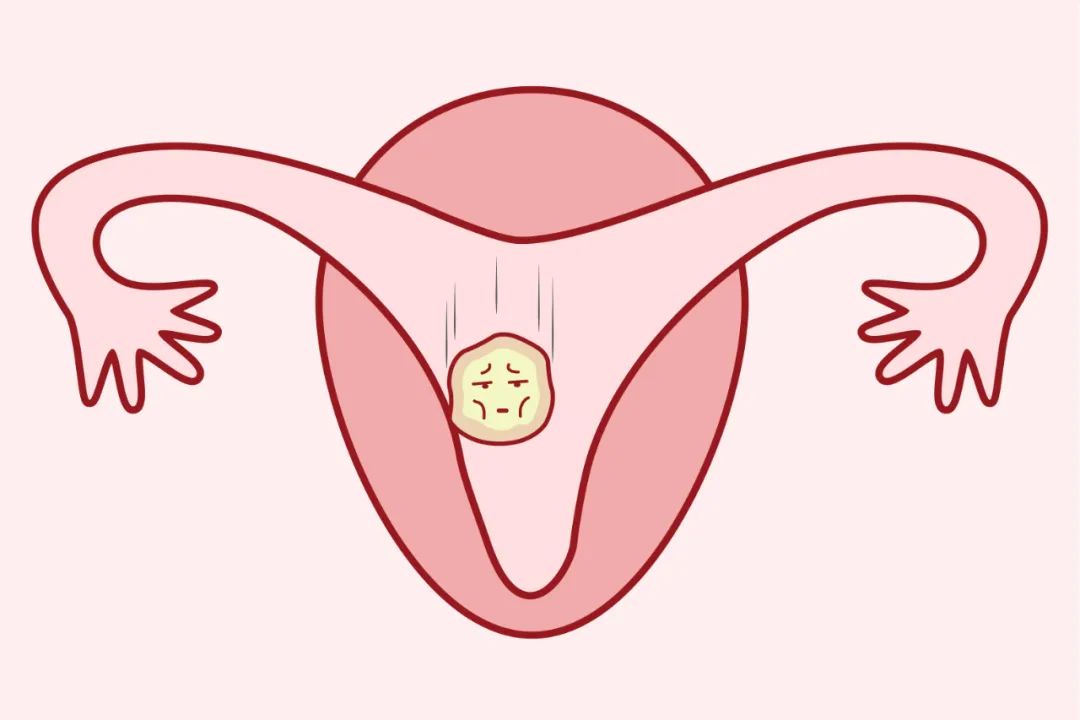 �Թ�Ӥ����ֲ���гɹ���Ϊ��Ҫ����ô�ౣ̥ҩ?